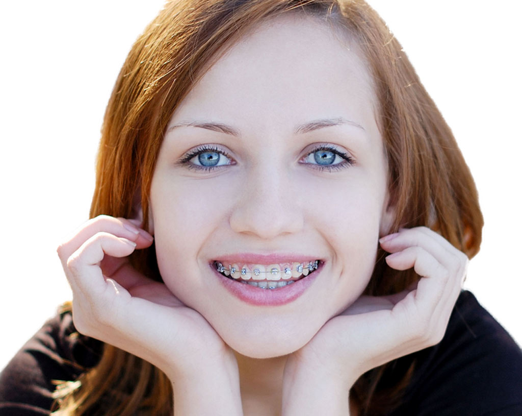 Dental braces: When to start